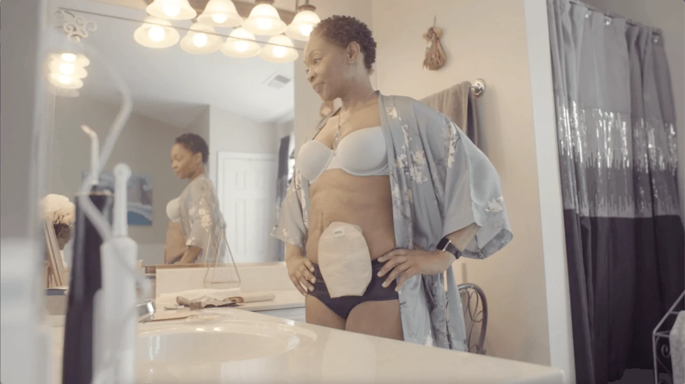 woman wearing ostomy pouch