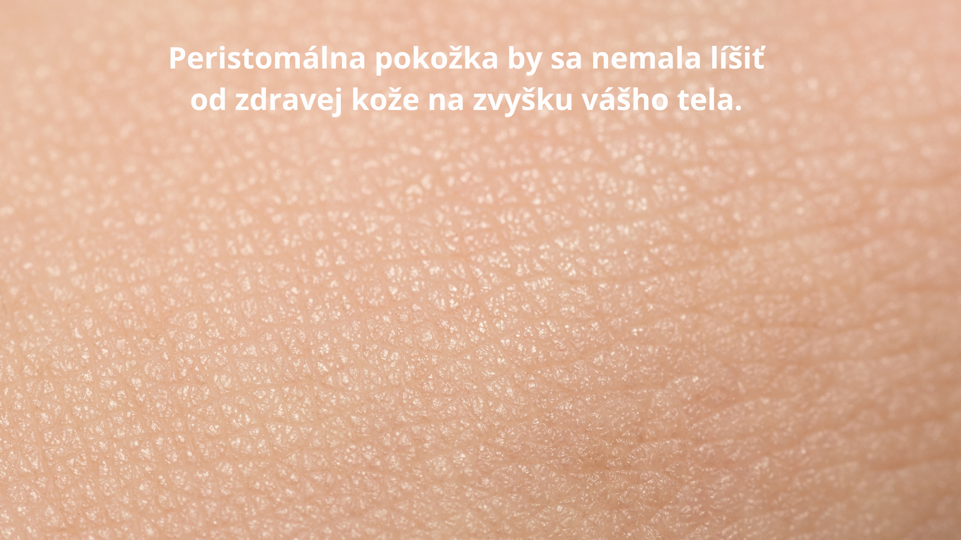 Pozadie